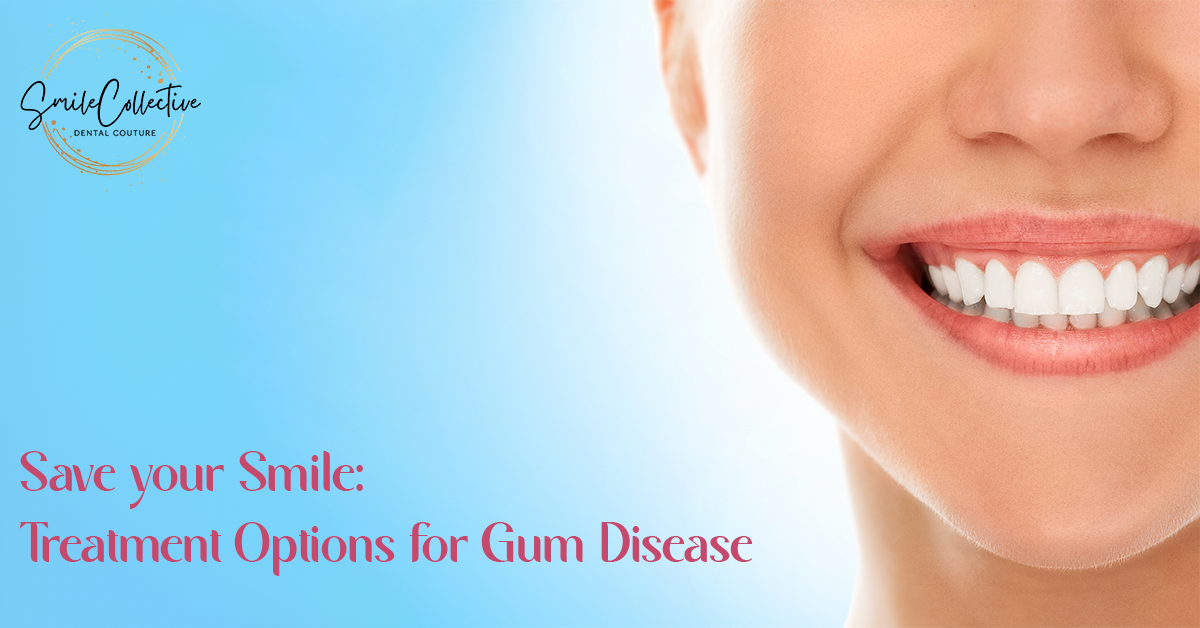 You are currently viewing Save your Smile: Treatment Options for Gum Disease
